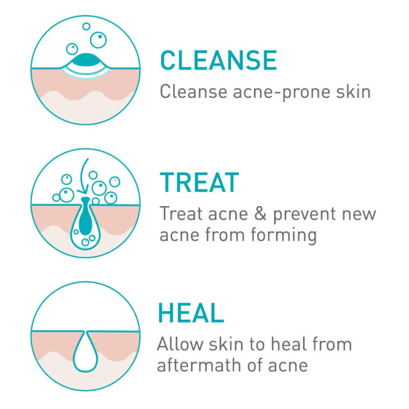 CeraVe Acne Foaming Cream Cleanser 150ml (clears acne pimples and blackheads) - Image 3